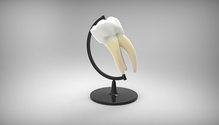 implant-dentar-din-Bucuresti